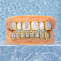 White Shell & Oval Cut Diamond Grillz