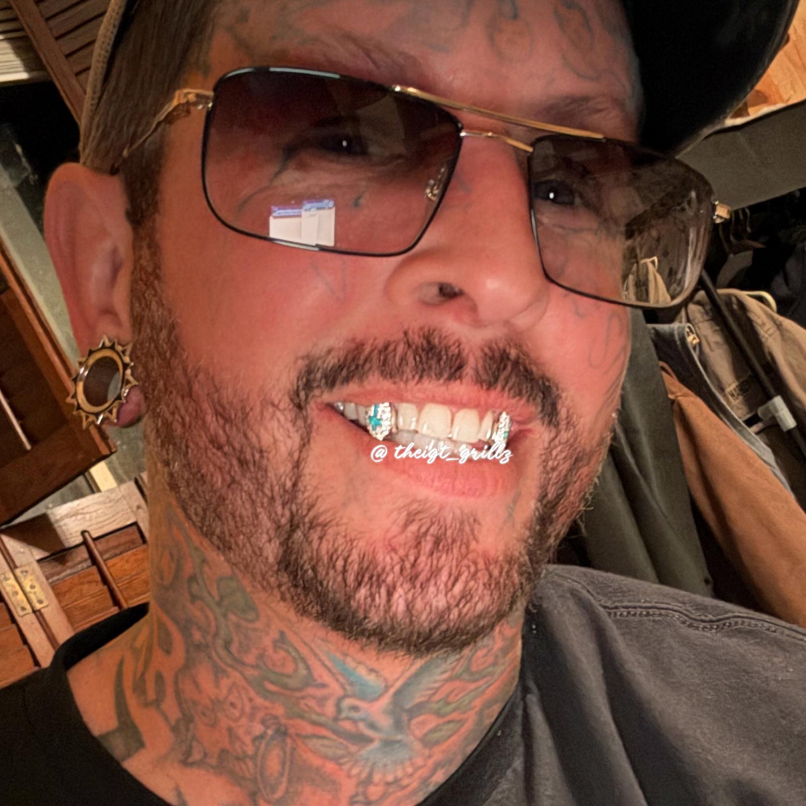 Opal Inverted Cross Tooth Caps - Moissanite Grillz | ICEGIANT