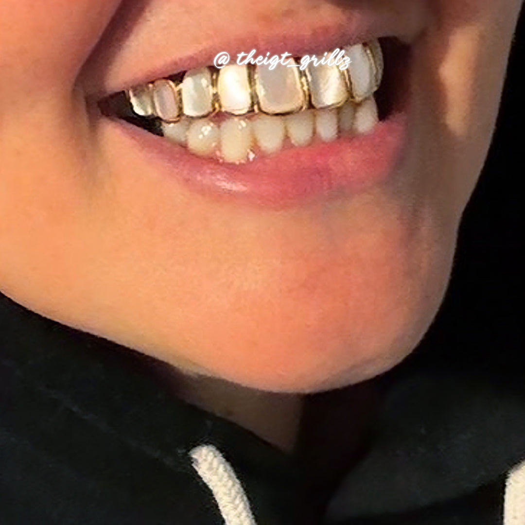 White Shell Grillz