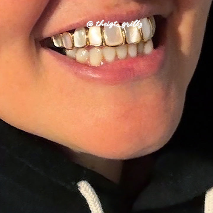 White Shell Grillz