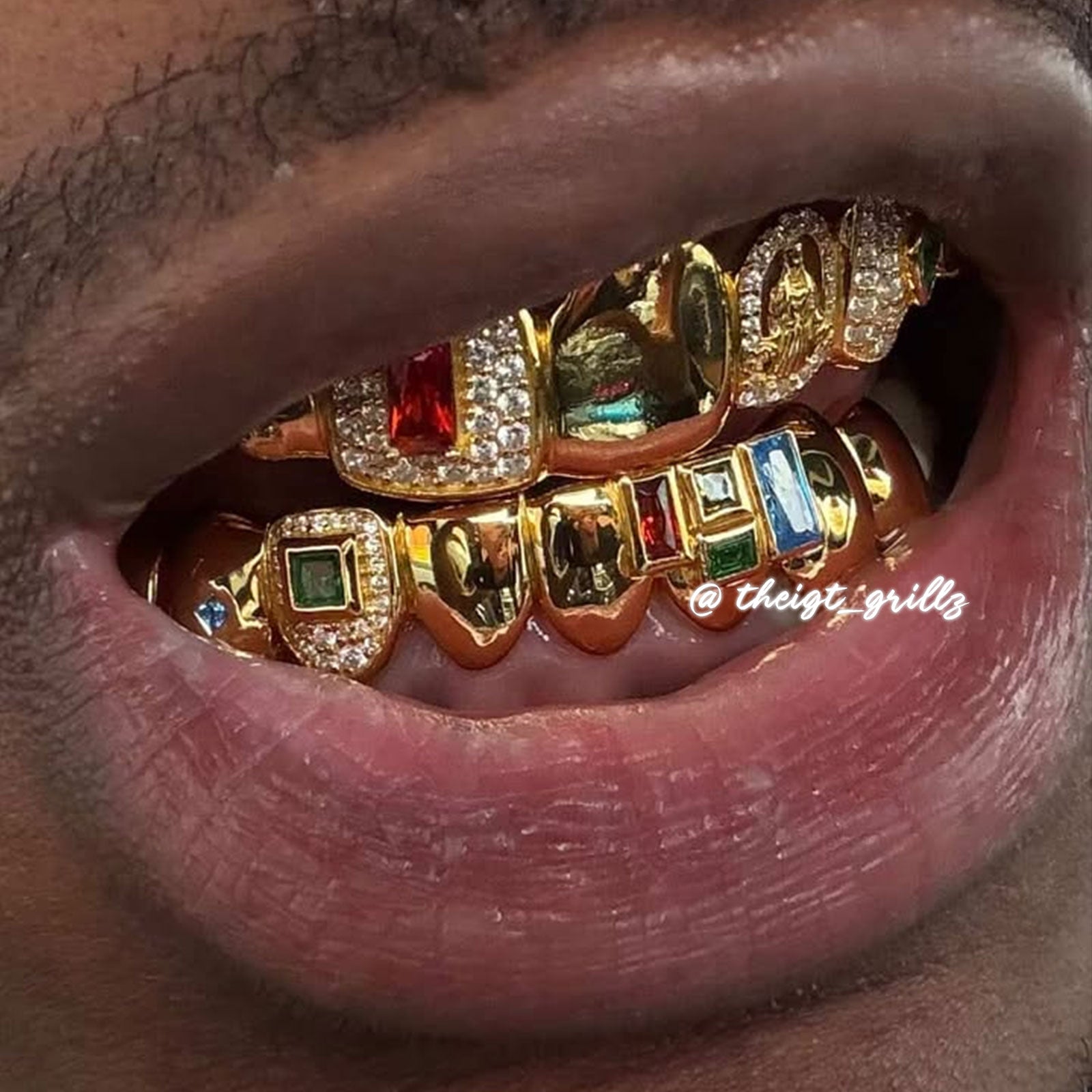 アフロ！X-LARGE×GRILLZ 10k VVs Lab Grown Diamonds Iced Out Grillz - DQ1004 – Gold Teeth