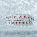 Custom Red Gemstone Grillz