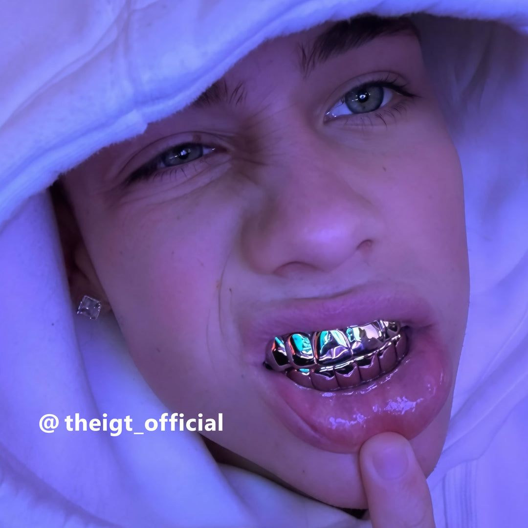 Custom Polished Gold Grillz