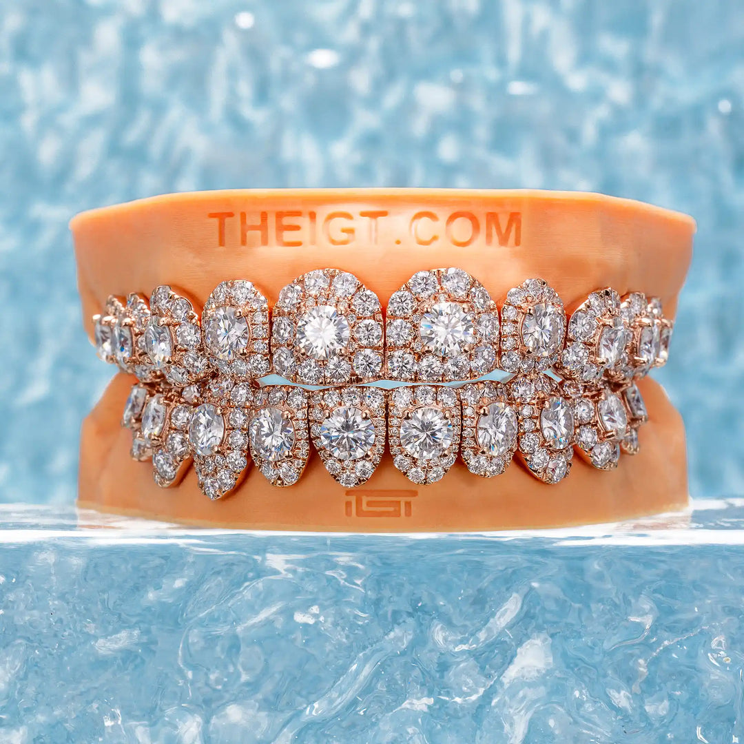 50 Pointer Stone On Center Moissanite Diamond Grillz