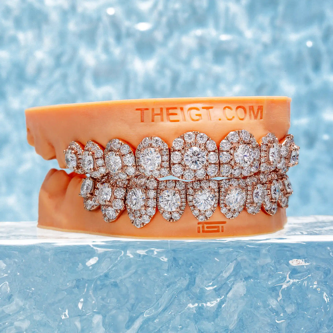 50 Pointer Stone On Center Moissanite Diamond Grillz