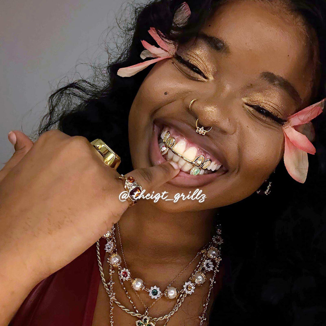 Double Star Cap (Top) W Opal & Kitty (Bottom) Grillz