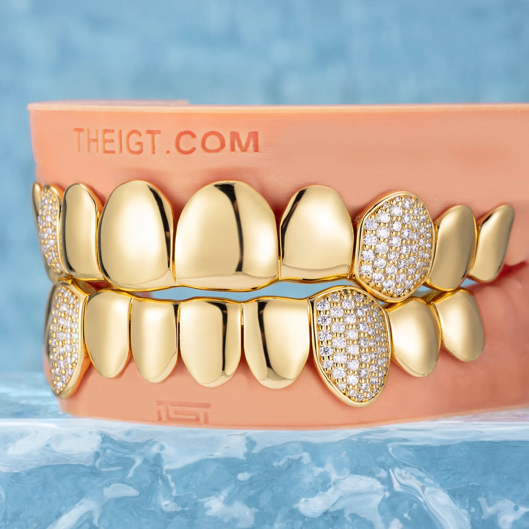 Custom Polished Gold & Diamond Grillz