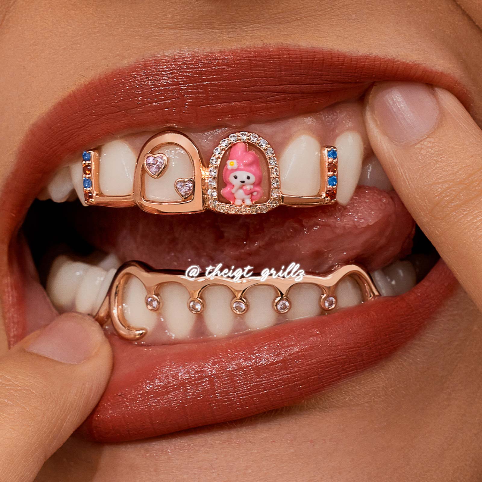 Pink Bunny Custom Grillz