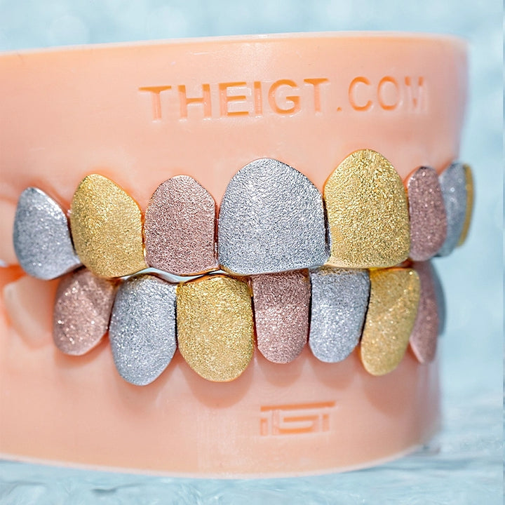 Custom Tri-Tone Diamond Dust Grillz
