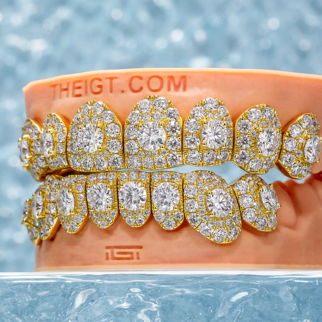 50 Pointer Stone On Center Moissanite Diamond Grillz