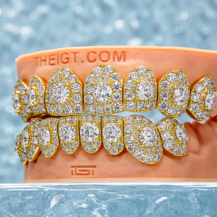 50 Pointer Stone On Center Moissanite Diamond Grillz