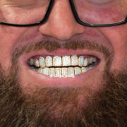 Pave Setting Opal Diamond Grillz