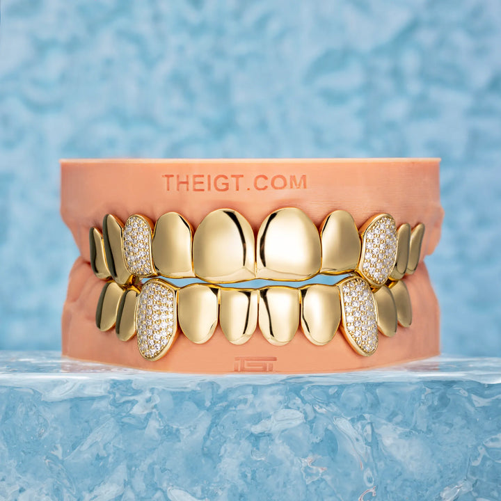 Custom Polished Gold & Diamond Grillz