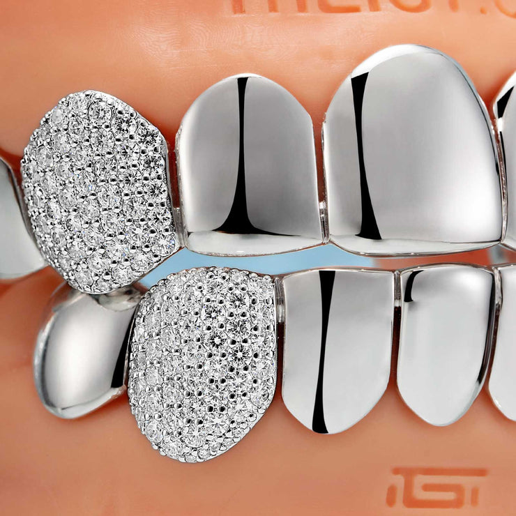 Custom Polished Gold & Diamond Grillz