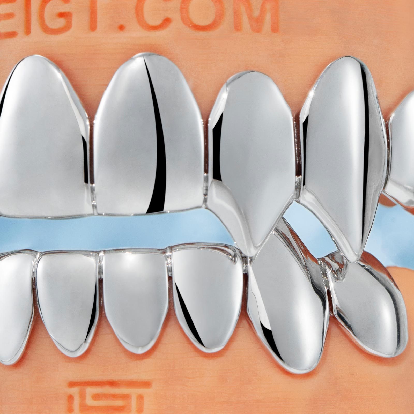 FULLY VAMPIRE POLISHED GOLD GRILLZ