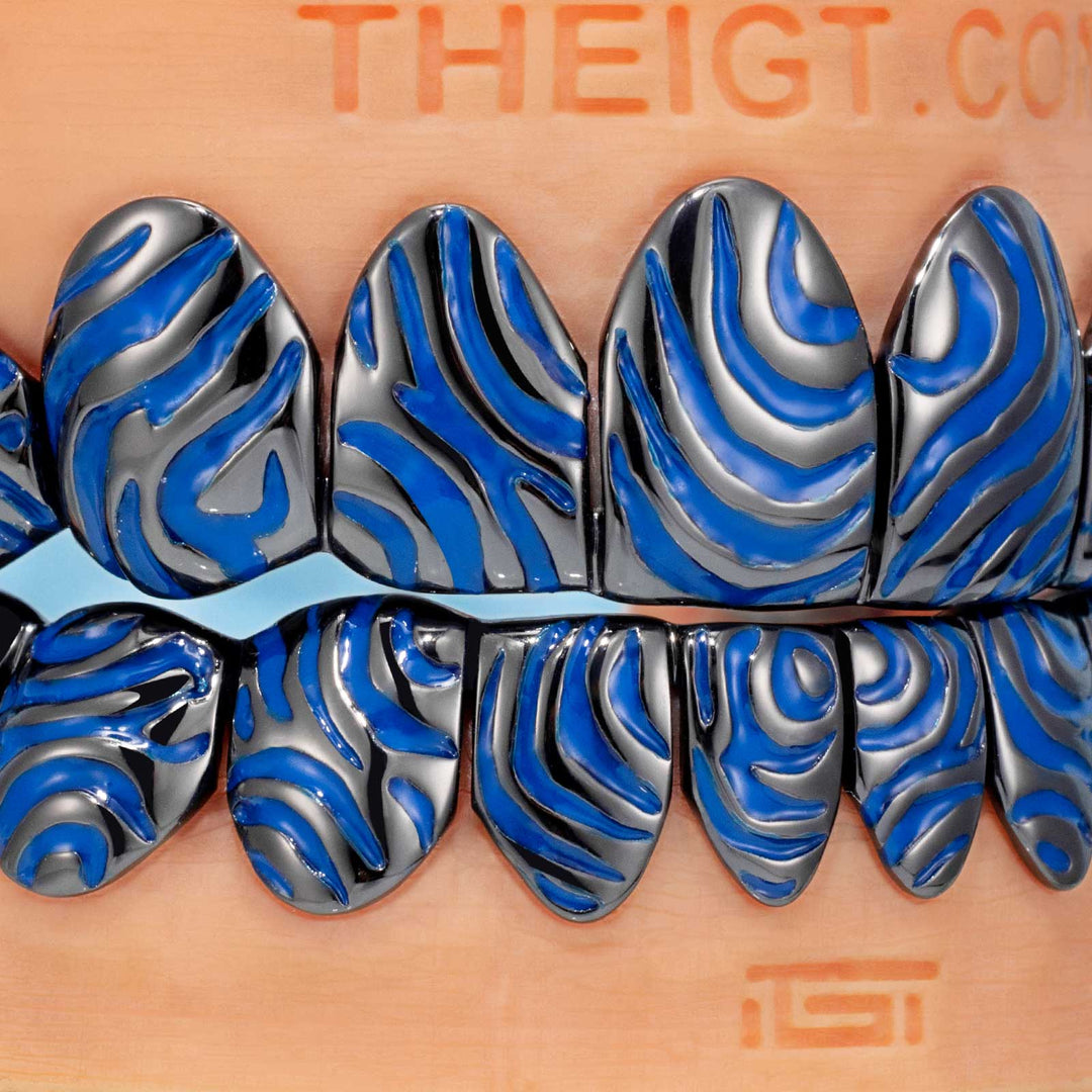 Stripe Patterns Grillz