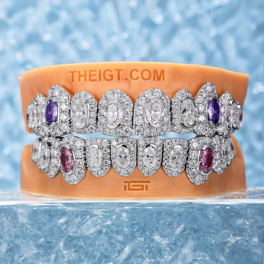 Honeymoon Set Round & Oval Cut Diamond Grillz