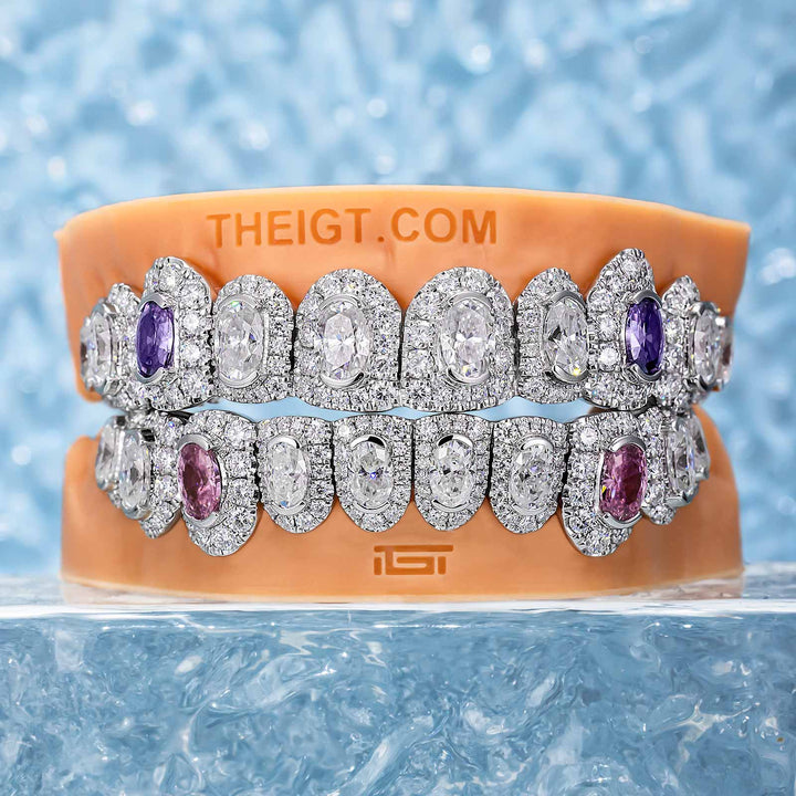 Honeymoon Set Round & Oval Cut Diamond Grillz