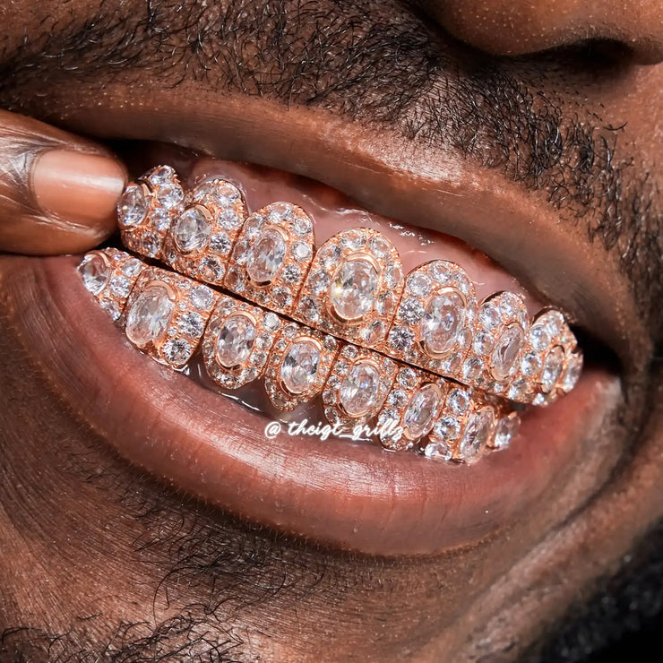 Honeymoon Set Round & Oval Cut Diamond Grillz