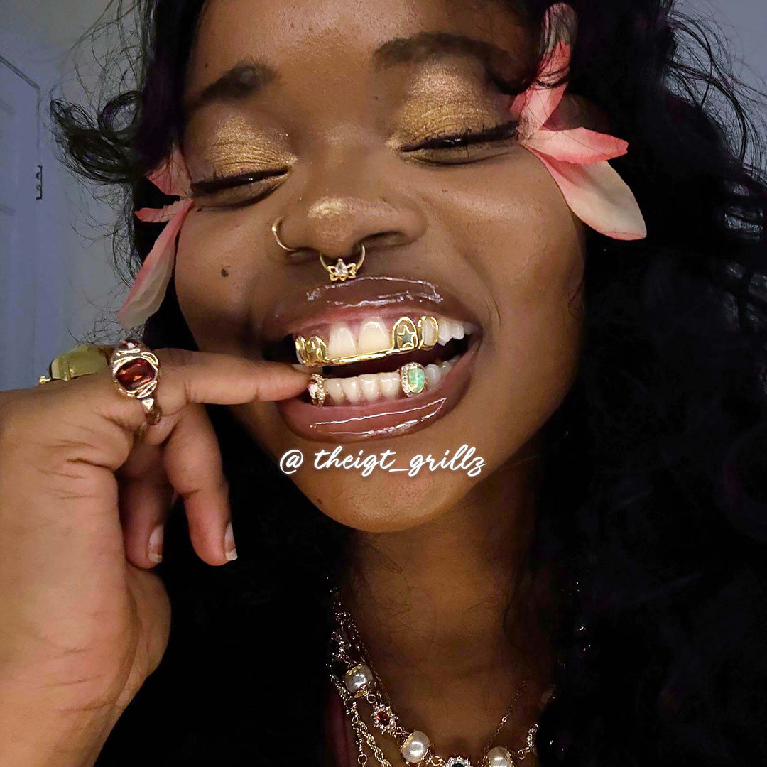 Double Star Cap (Top) W Opal & Kitty (Bottom) Grillz