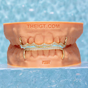 WAVE DIAMOND BAR GRILLZ