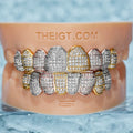 Custom Tri-Colored Diamond Grillz