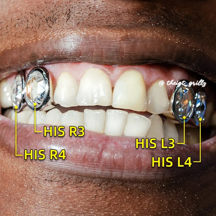 Custom Unique Single Oval Moissanite Grillz
