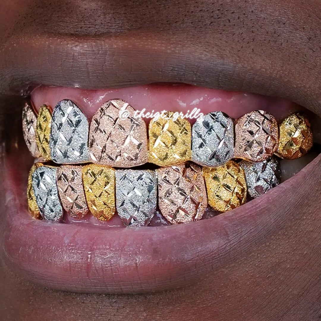 Custom Tri-Tone Diamond Dust And Diamond Cut Grillz