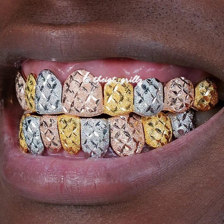 Custom Tri-Tone Diamond Dust And Diamond Cut Grillz