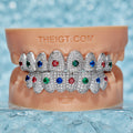 Custom Colored Gemstone Grillz