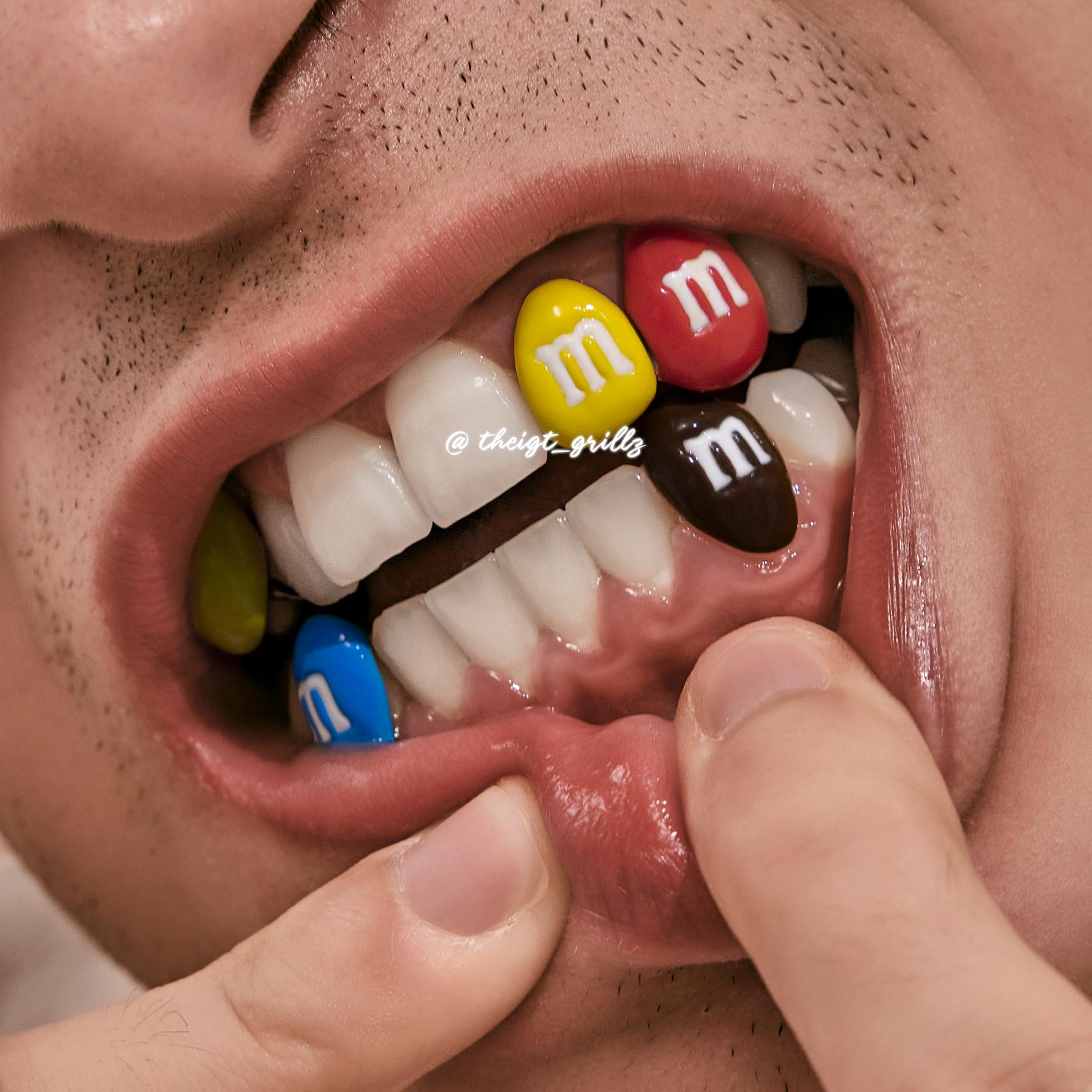 M'M's' Style Grillz – Cute Grillz for Female Street Style| TheIGT