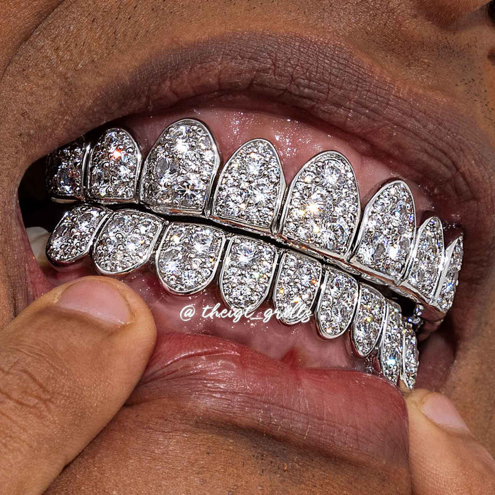 Mosaic/Snow Set Moissanite Diamond Grillz