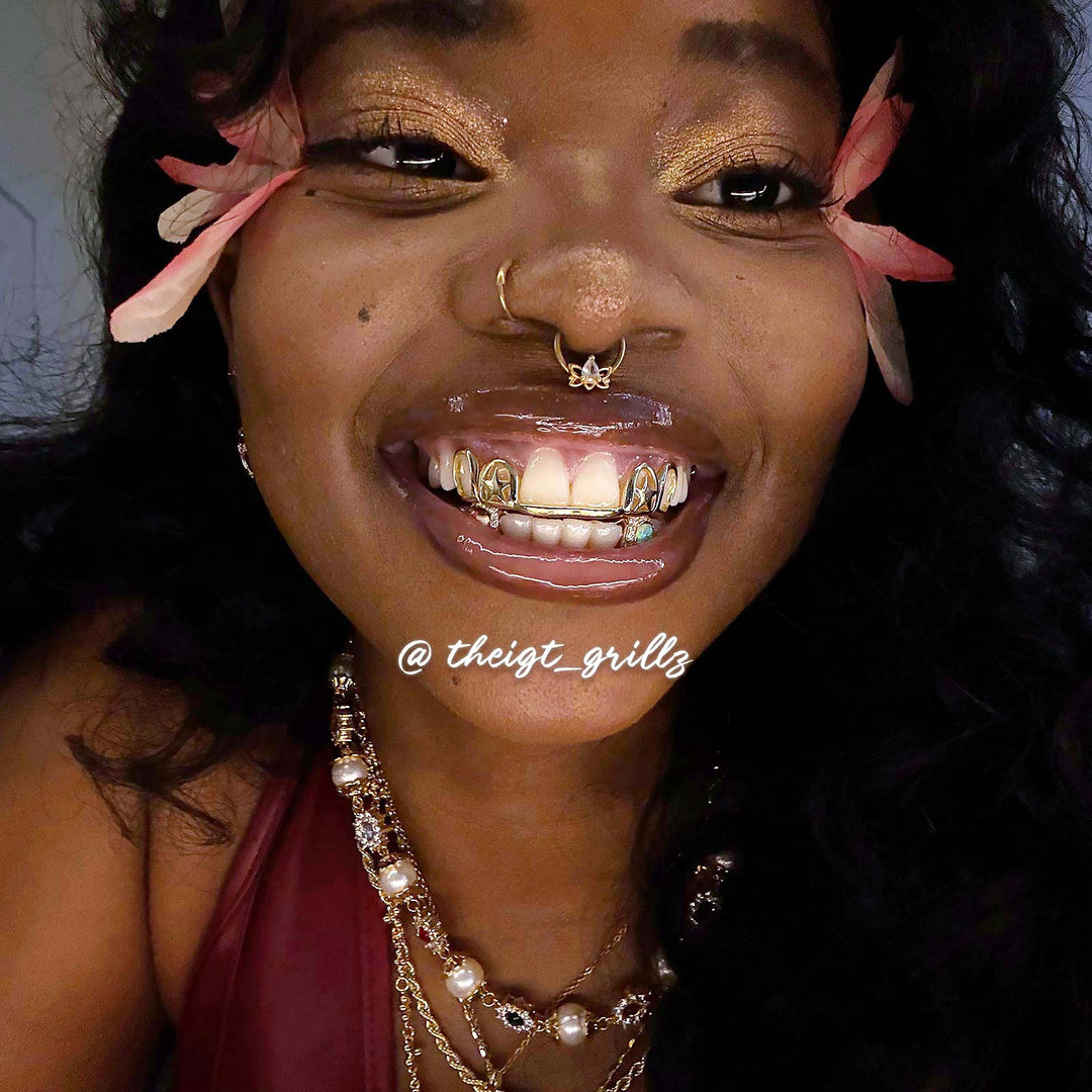 Double Star Cap (Top) W Opal & Kitty (Bottom) Grillz