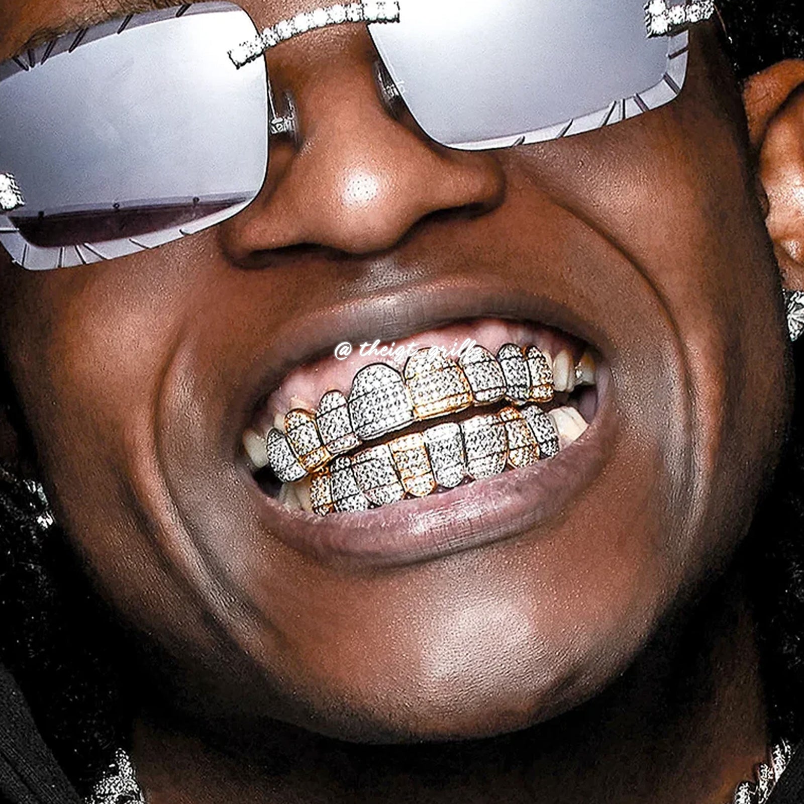 Tri-Colored Silver Diamond Grillz - Custom Ice - IGT – ICEGIANT