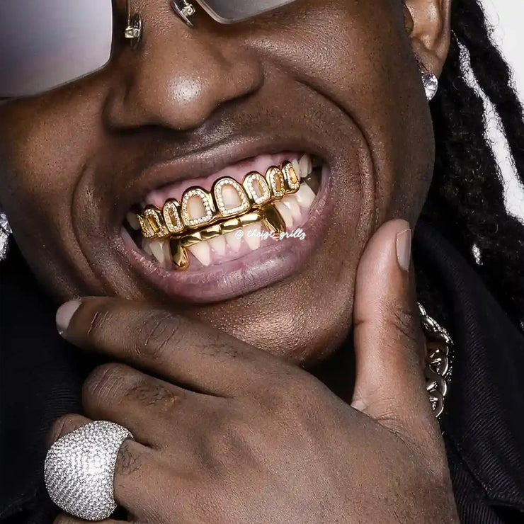 Custom Iced Out Open-Face Grillz