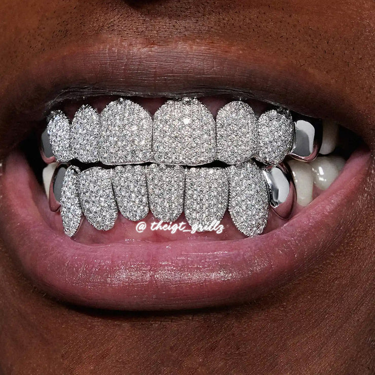 Custom End Capped Moissanite Grillz