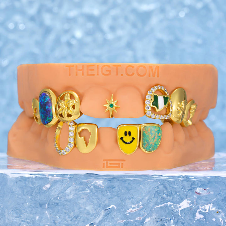 African Eagle Opal Grillz