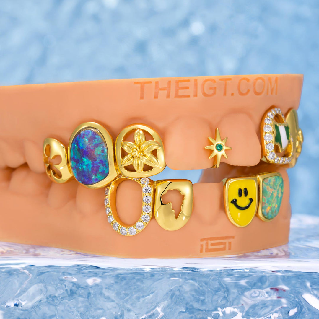 African Eagle Opal Grillz