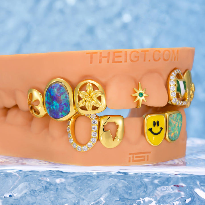 African Eagle Opal Grillz