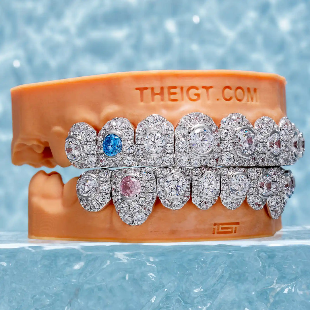 Big Pointer Set Round Cut Diamond Grillz