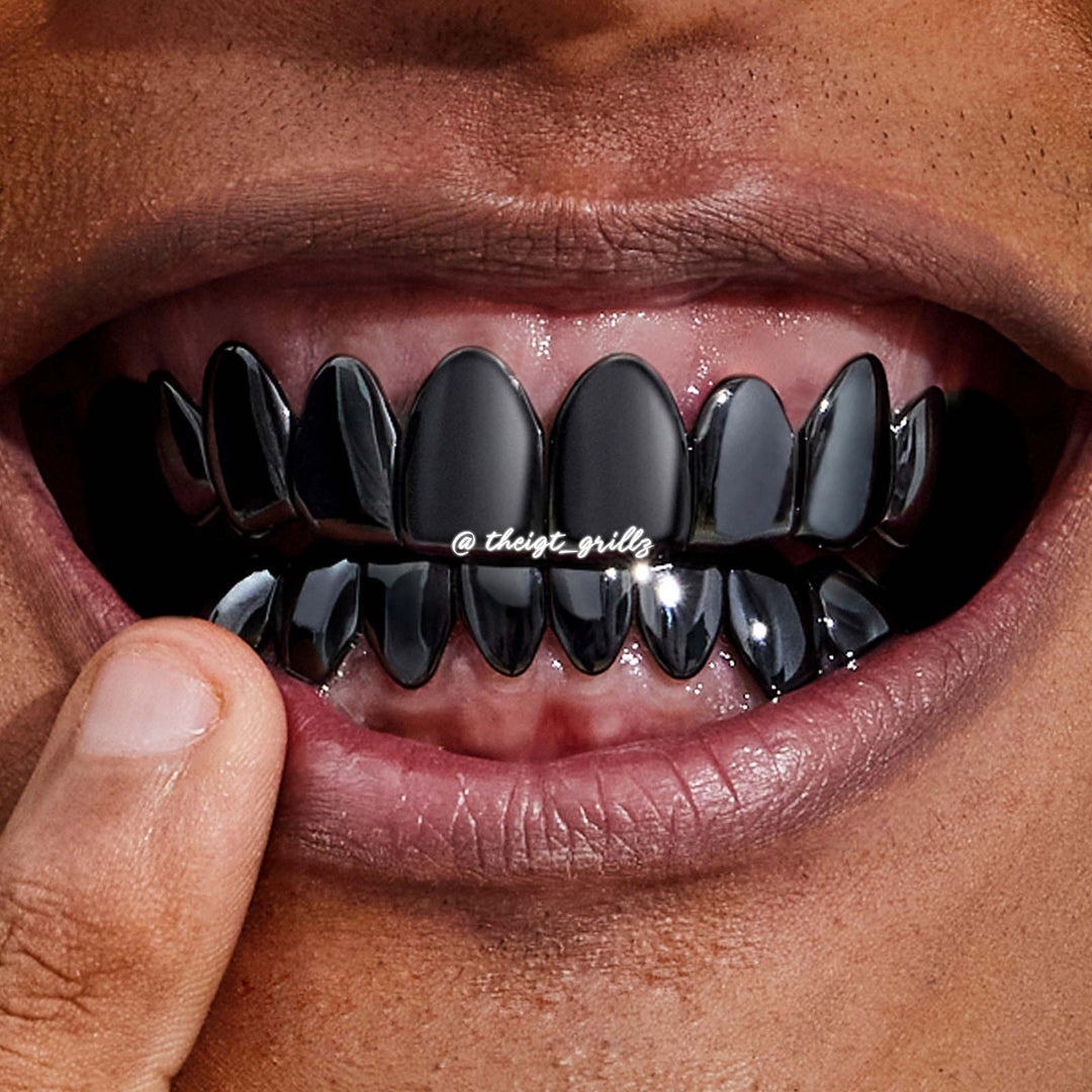 Black Gold Grillz