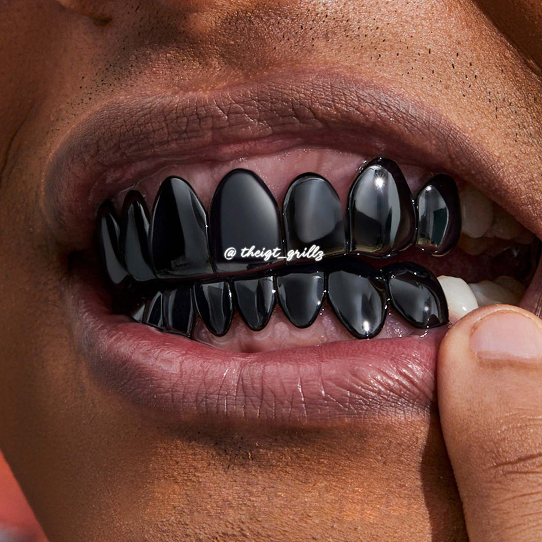 Black Gold Grillz