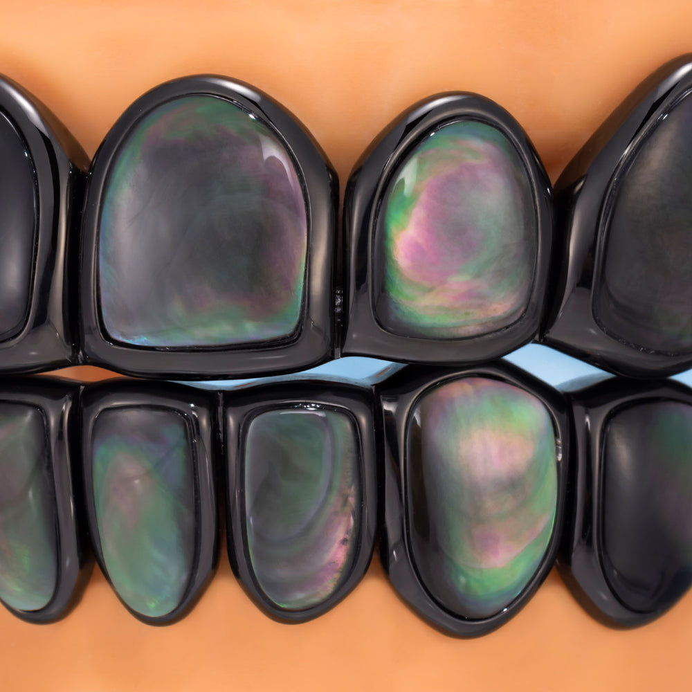 Shell Grill Bridge Beyond Gold: Enamel Porcelain & Shell Grillz | ICEGIANT