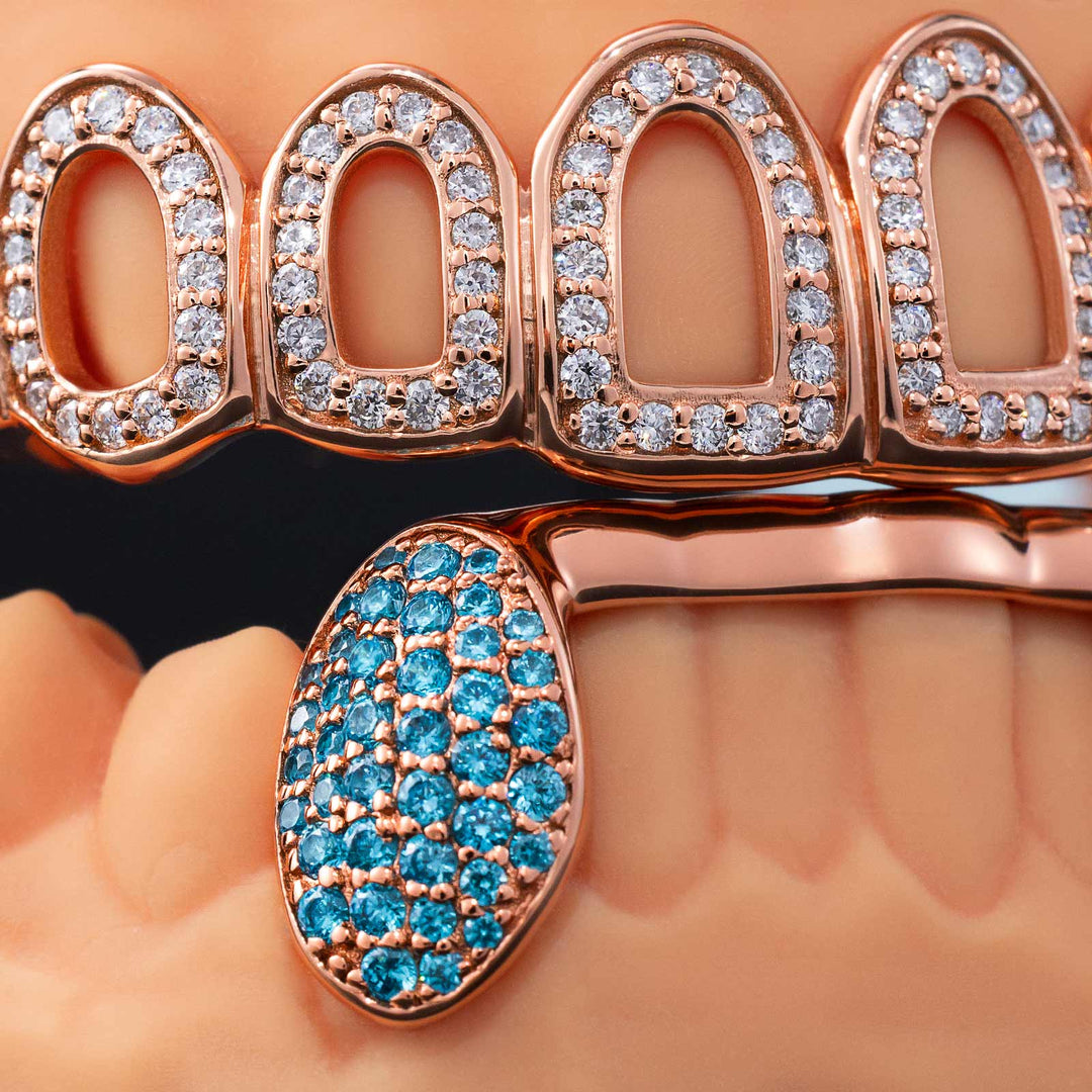 Custom Iced Out Open-Face Grillz