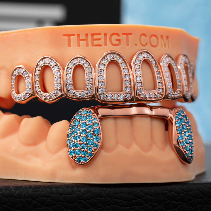 Custom Iced Out Open-Face Grillz