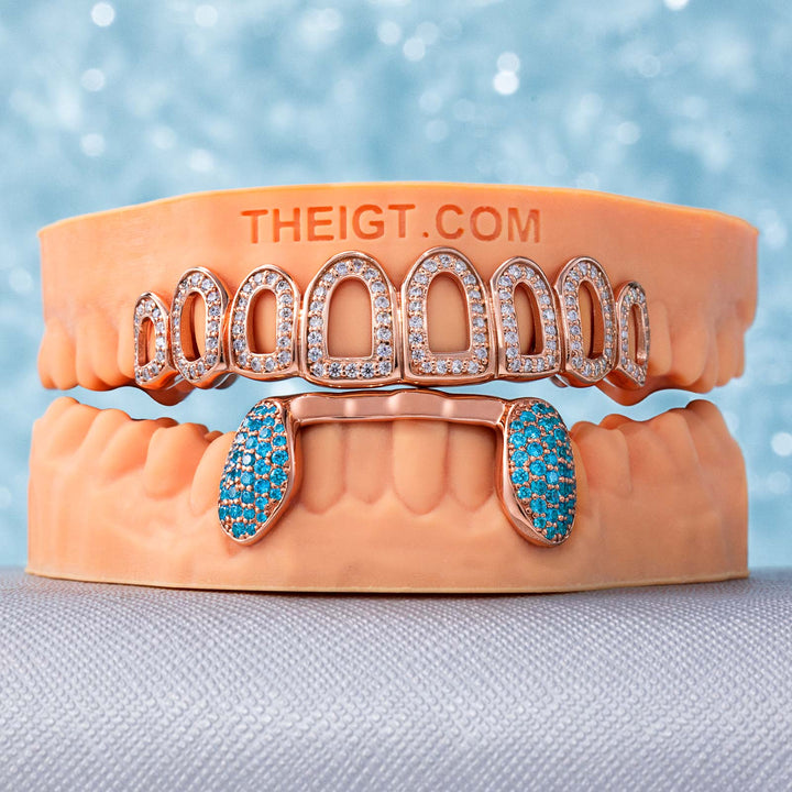 Custom Iced Out Open-Face Grillz