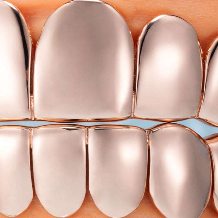 Custom Polished Gold Grillz