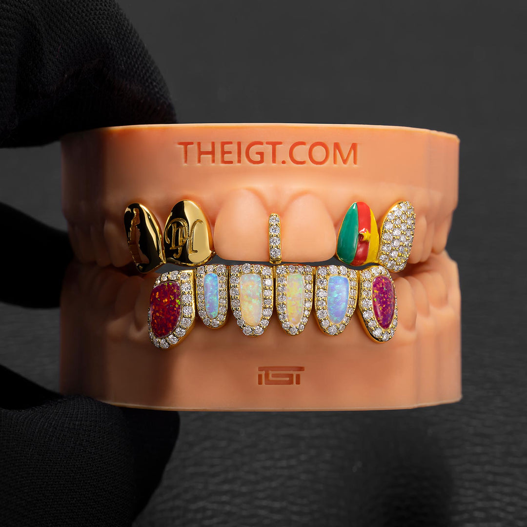 Cameroon Pride & Opal Grillz