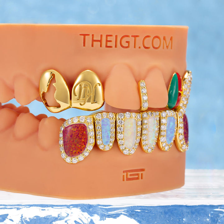 Cameroon Pride & Opal Grillz