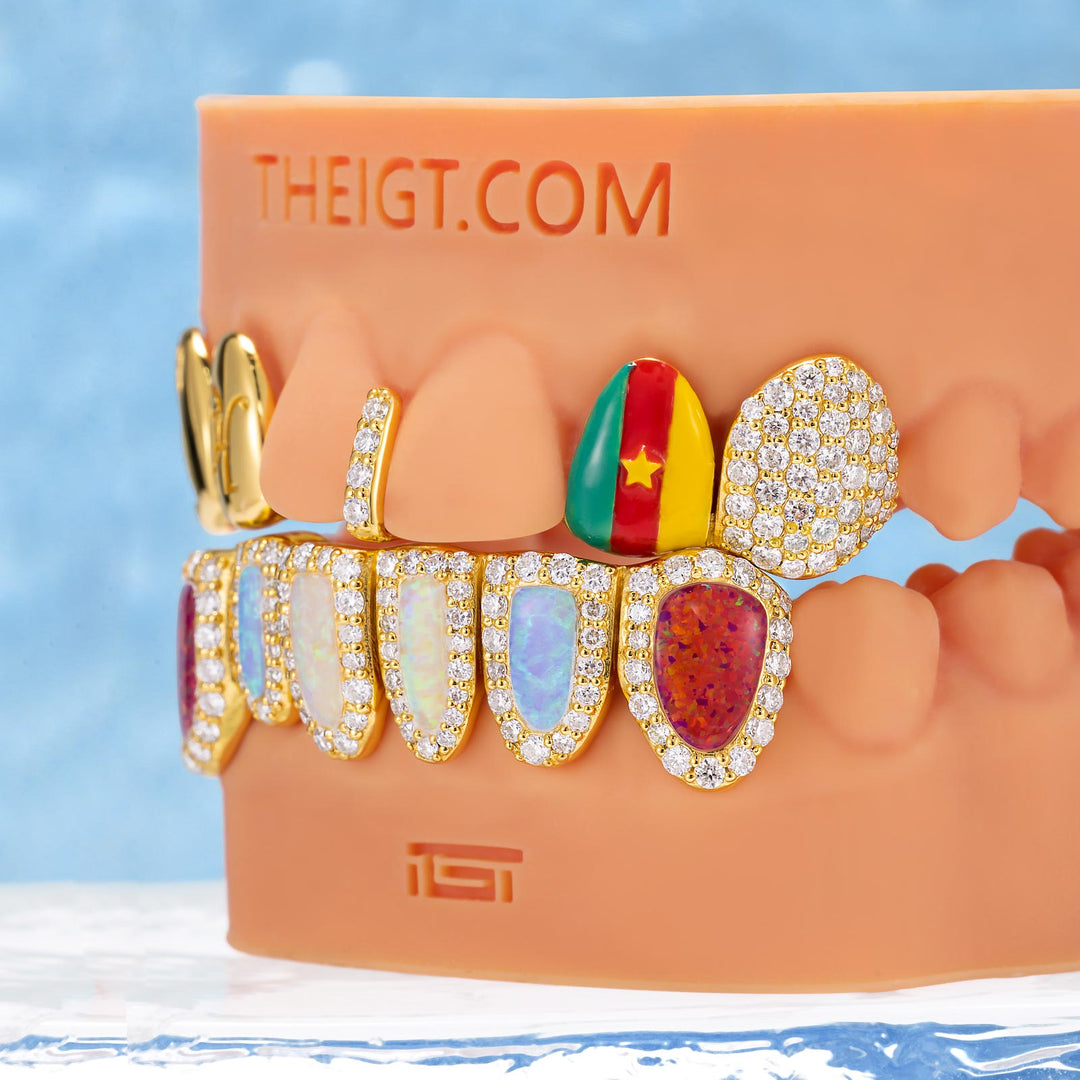 Cameroon Pride & Opal Grillz